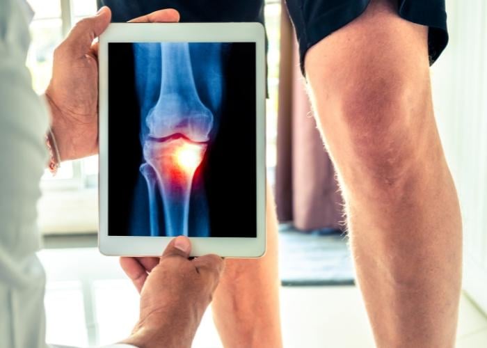 Common Knee Injuries after a Car Accident