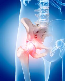 Fayetteville, GA Hip Pain Treatment Clinic